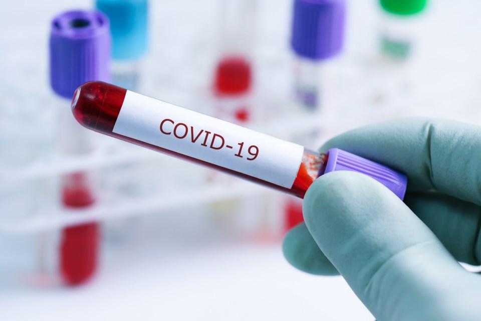 Ontario, Canada sees surge in cases of Covid-19